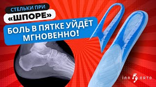 Гелевые стельки при пяточной шпоре - забудьте о боли в пятках!