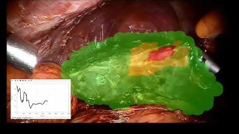 Vision-based Force Feedback Estimation for Robot-assisted Surgery