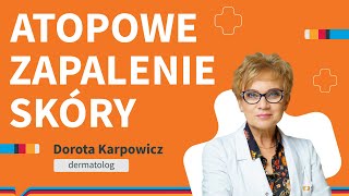 Atopowe zapalenie skóry – przyczyny, objawy, leczenie Atopowe zapalenie skóry – przyczyny, objawy, leczenie