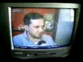 مقابلة تلفزيونية عن زراعة الاسنان بطريقة الدروبي.mp4