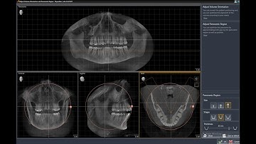 Sicat Air Tutorial 2 - Volume Preperation