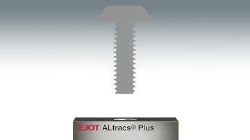 ALtracs® Plus Product Animation