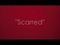 Scarred  jamestown story official lyric