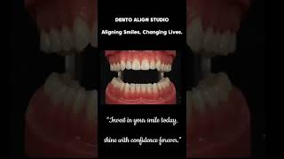 Transform Your Smile with Clear Aligners | Boost Confidence Every Day 😁
