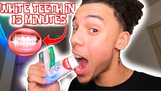 How I Got My WHITE TEETH TUTORIAL In 13 MINUTES (easy)