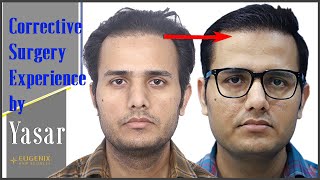 Hair Restoration I Corrective Surgery I 4 months update @EugenixHairSciencesofficial