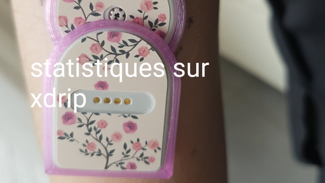 Statistiques sur xdrip avec un miao miao