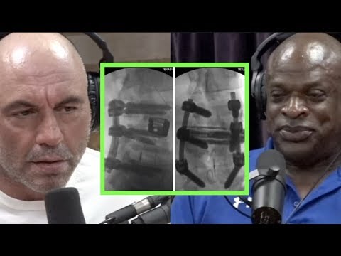 ⁣Ronnie Coleman Details His 13 Post Bodybuilding Sugeries | Joe Rogan