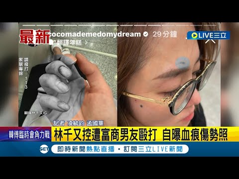 林千又控遭富商男友毆打 自曝血痕傷勢照！ 林千又富商男友身分曝 是"台積電供應商"｜記者 凌毓鈞 孟國華｜【LIVE大現場】20240217｜三立新聞台