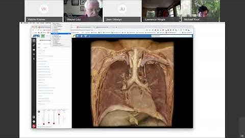APR (+ Practice Atlas) Implementation