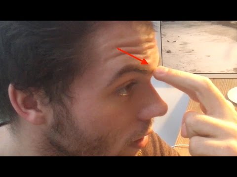 Video: Doet neusspoeling pijn?