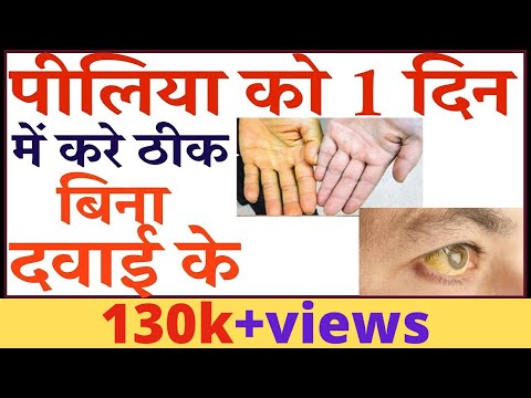 पीलिया को 1 दिन में करे ठीक बिना दवाई के | Treatment For Jaundice | Natural Ways To Cure Piliya