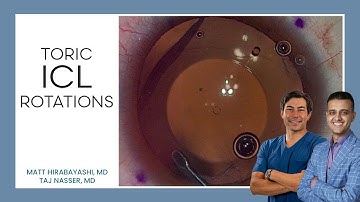 Rotated Toric ICLs (When and How to Rotate Them Back)