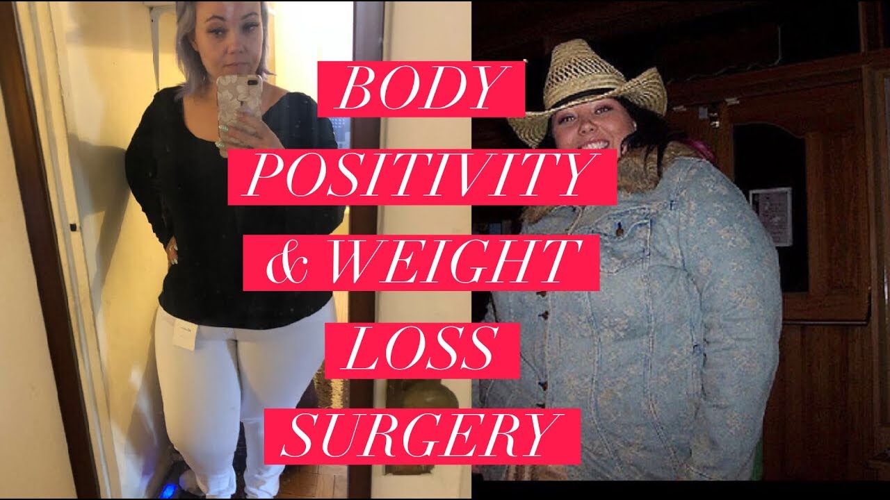 Body Positivity & Weight Loss Surgery - Can you HAVE BOTH!? - YouTube