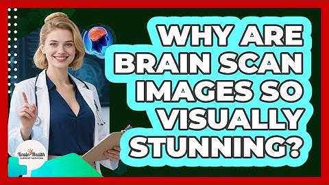 Why Are Brain Scan Images So Visually Stunning? - Brain Health Support Network