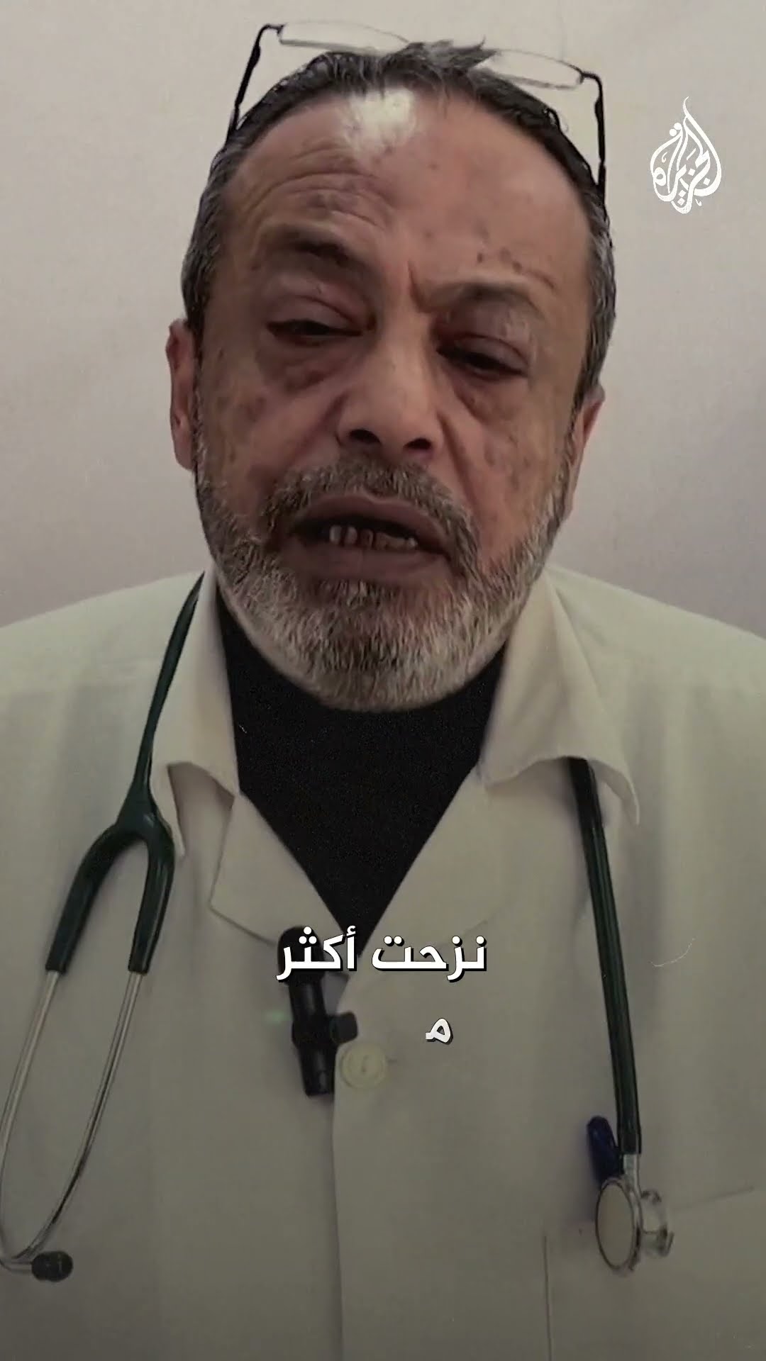 رغم بتر ساقه.. طبيب أطفال يصرّ على مواصلة عمله في غزة