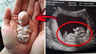 23 Bébés Inhabituels Qui Existent Vraiment !