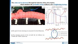 Sigmoid-Colon-Straightening Soft Actuator With Peristaltic Motion for Colonoscopy Insertion screenshot 2
