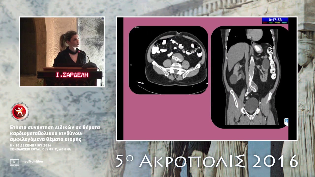 Ι. Σαρδέλη  Αξονική τομογραφία - Αγγειογραφία πότε θα μας βοηθήσει;