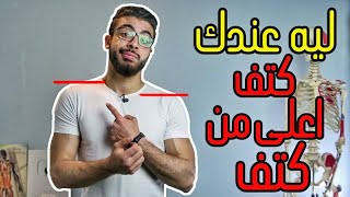 ليه عندك كتف اعلي من التاني ؟!