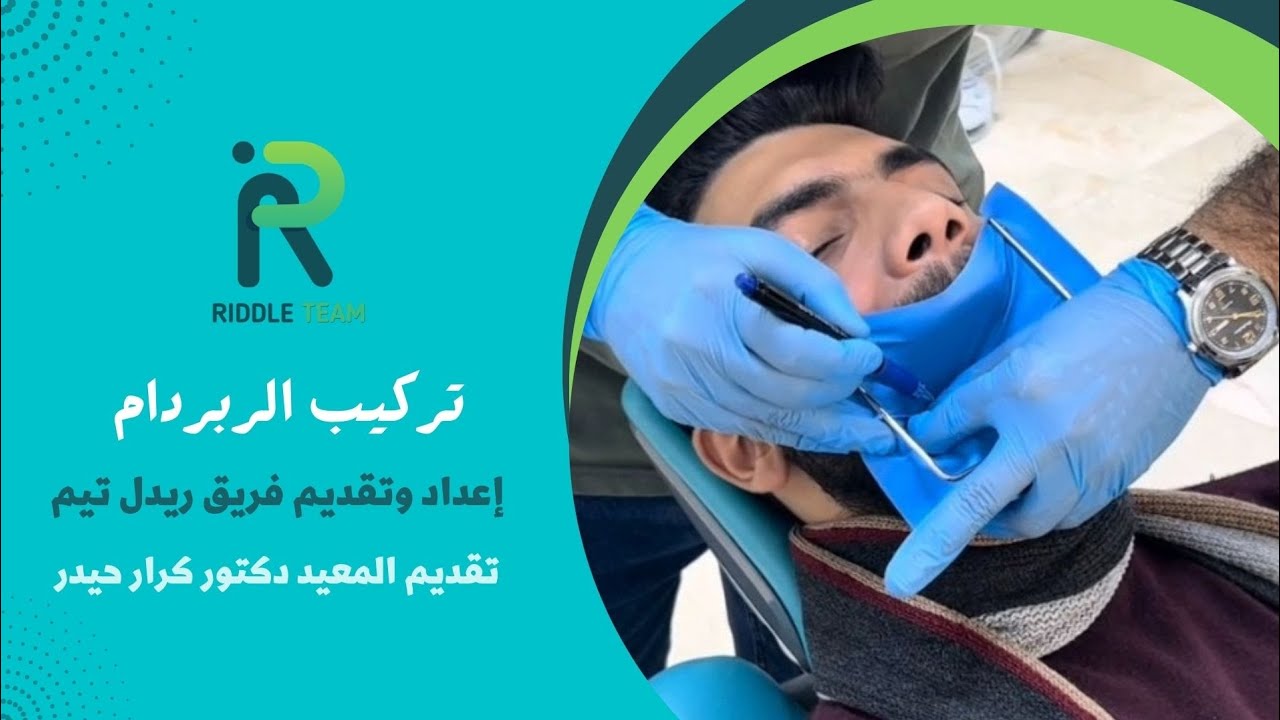 طريقة تركيب الربردام تقديم المعيد دكتور كرار إعداد فريق ريدل تيم Riddle Team