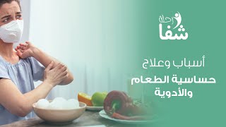 أسباب و علاج حساسية الطعام و الأدوية