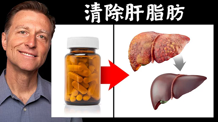 清除脂肪肝, 最好的维他命胆碱,自然疗法,柏格医生 Dr Berg - 天天要闻
