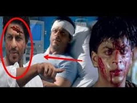 Top 10 Actors Who Were Seriously Injured During Filming 
