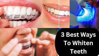 3 Best Ways To Whiten Teeth