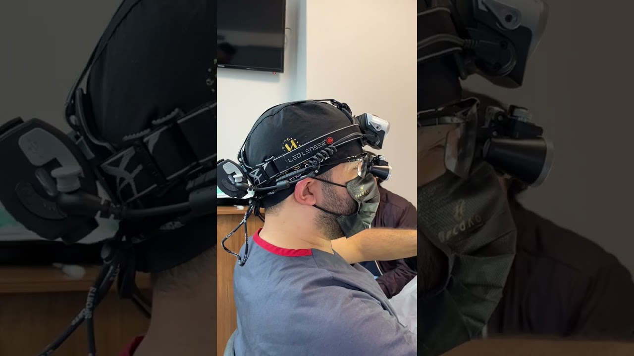 Best Hair Transplant Surgeon in Istanbul