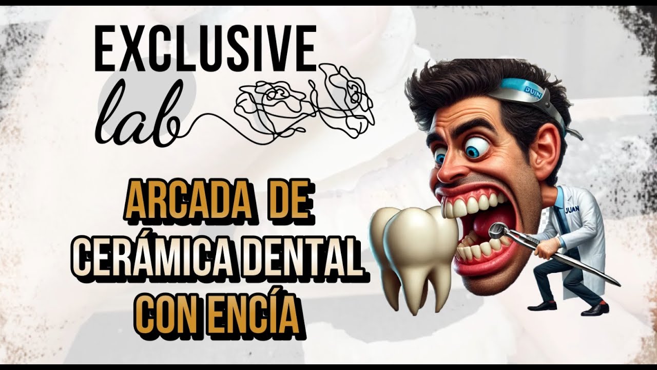 Proceso detallado de cargas sobre 