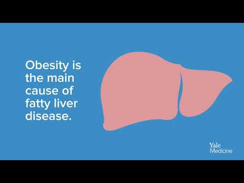 Fatty Liver Disease: An (Animated) Explanation - YouTube