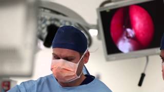 Corticosteroid nasal irrigations after endoscopic sinus surgery