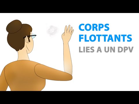 Vidéo: Qui peut diagnostiquer les corps flottants ?