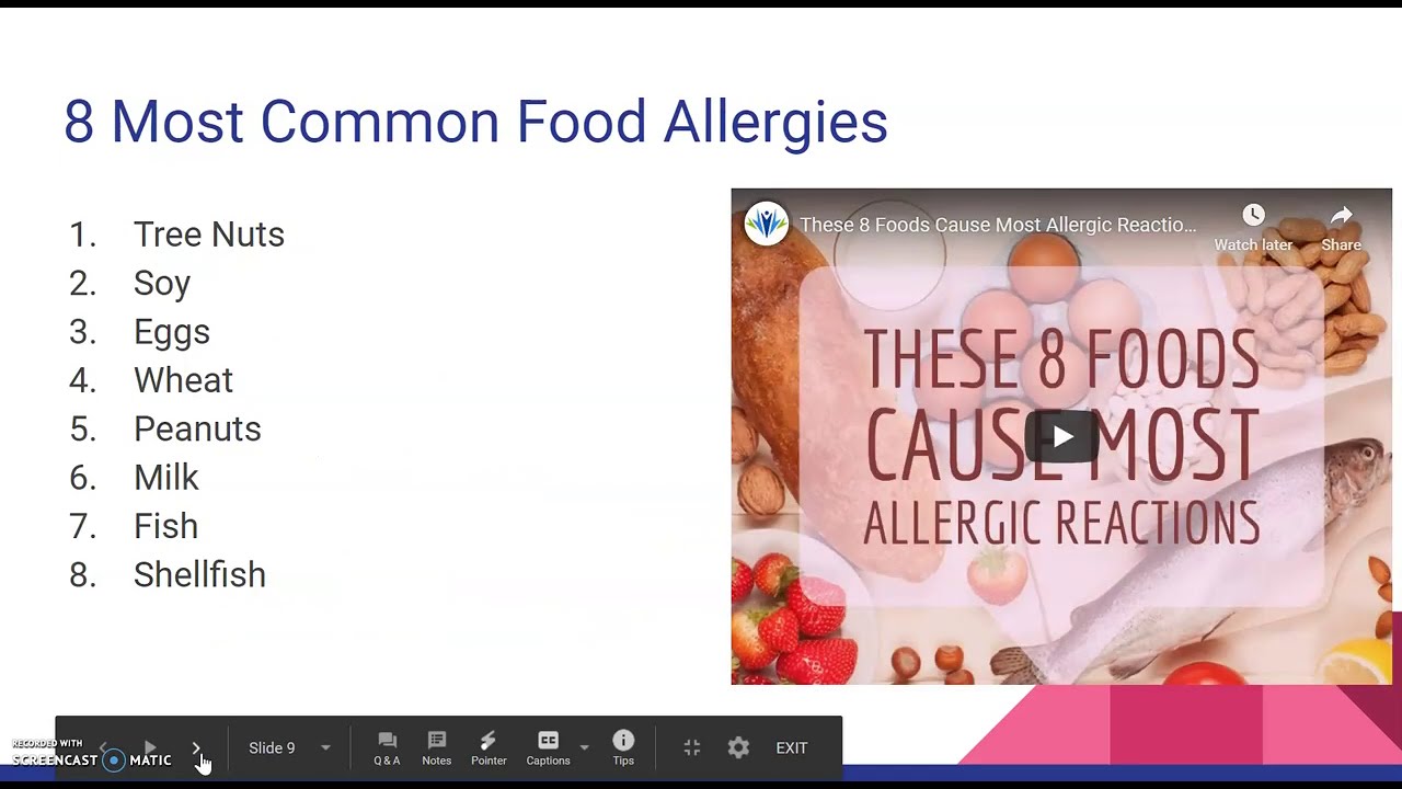 Special dietary needs