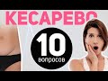 10 спортивных вопросов о кесаревом сечении: виды разреза, пресс, вакуум, похудение после кесарева