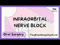 INFRAORBITAL NERVE BLOCK TECHNIQUE | Tips for finding the infraorbital foramen