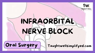 INFRAORBITAL NERVE BLOCK TECHNIQUE | Tips for finding the infraorbital foramen