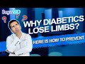Do DIABETICS REALLY LOSE LIMBS or GET AMPUTATED OFTEN?