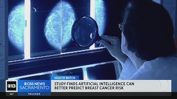 Study finds AI can better predict breast cancer risk