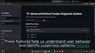 Eye disease prediction and Diagnosis || Major Project