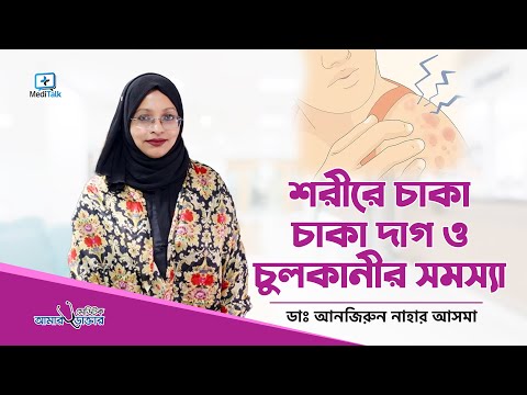 ভিডিও: রক্তের দাগ কি সিক্যুয়াল পাবে?