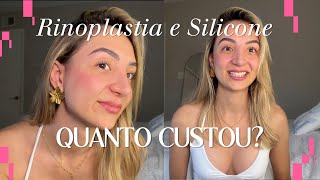 Rinoplastia E Silicone Tudo Sobre A Cirurgia, Valores E O Resultado Final