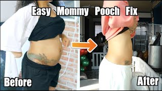 How I Fixed My Tummy Pooch After Twins/ Ab Separation Post-partum Fitness Journey/ Diastasis Recti