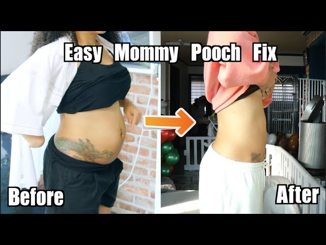 How I Fixed My Tummy Pooch After Twins/ Ab Separation Post-partum