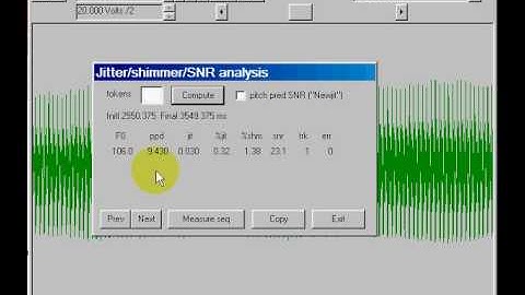 Tasko Speech Lab: Voice perturbation analysis