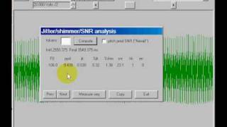 Celebrity Tasko Speech Lab: Voice perturbation analysis Profile