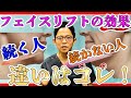 【フェイスリフトの効果はいつまで続く?】効果を長引かせたいならコレを必ずしてください!