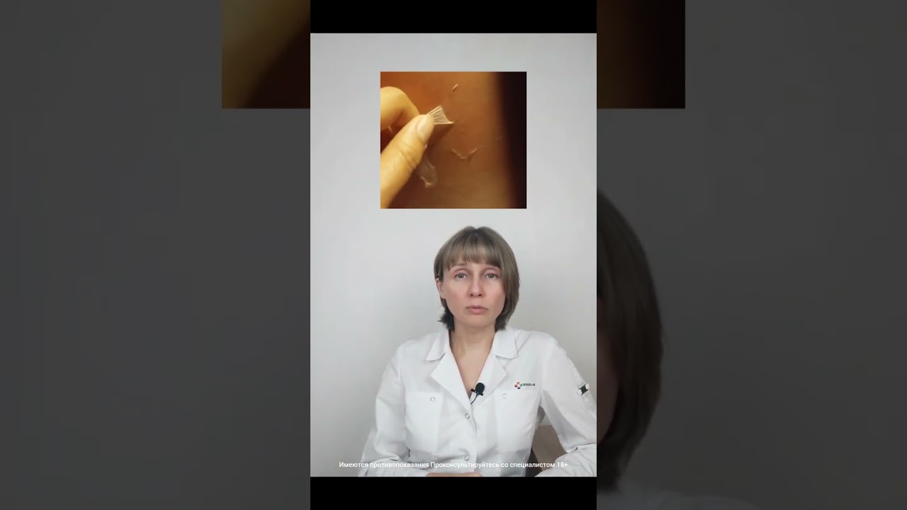 Меланин и мелатонин Доктор Лисенкова 