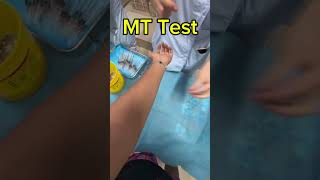 Tuberculosis (TB) Test #tbtest #medical #reels #shorts
